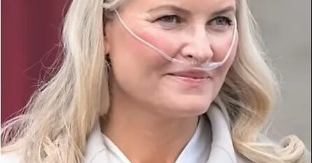 Norwegian Princess Mette Marit may need a lung transplant: what makes this operation special?
