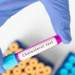 Milda shared how she managed to "shed" cholesterol: I couldn't believe it myself