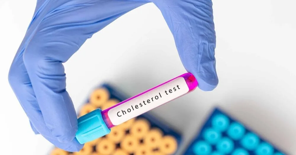 Milda shared how she managed to "shed" cholesterol: I couldn't believe it myself