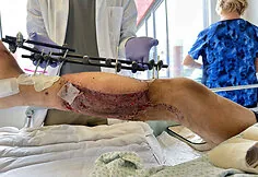 Adrian, who suffered a severe accident