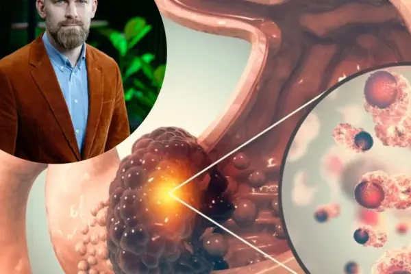 Stomach cancer is increasingly diagnosed in younger people: what's going on here?