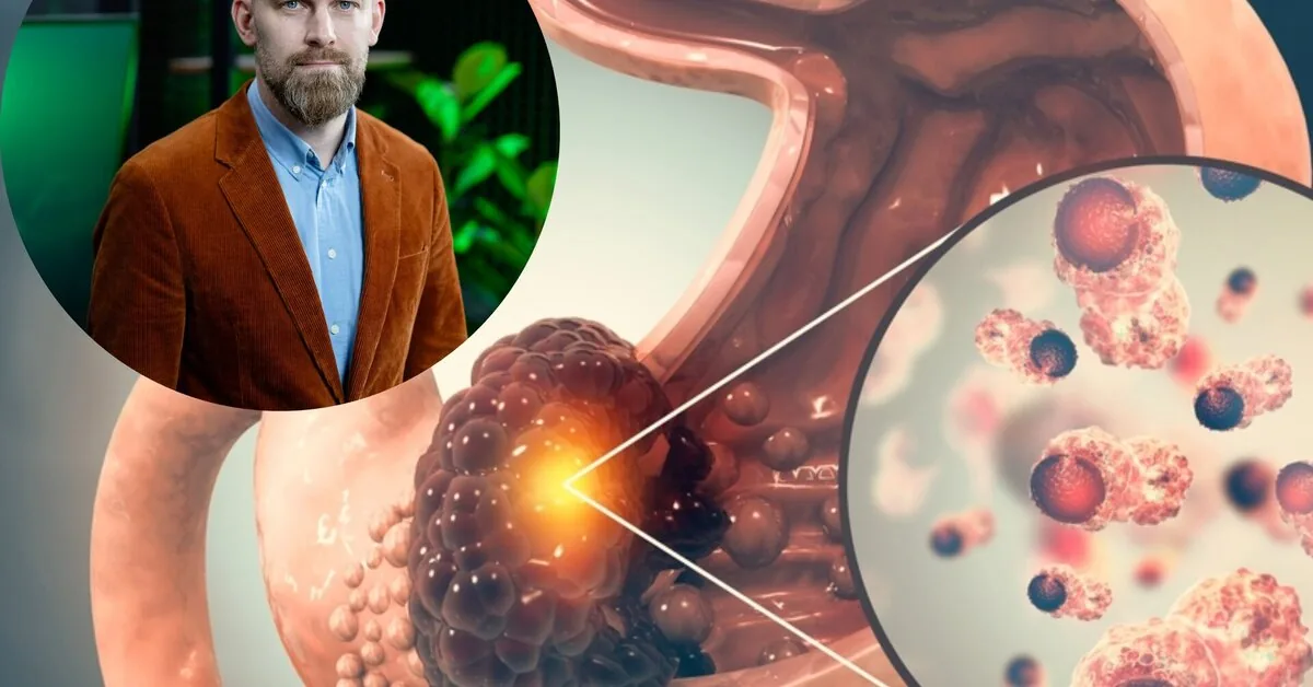 Stomach cancer is increasingly diagnosed in younger people: what's going on here?