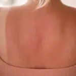 I thought I had a sunburn, but it turned out to be something else entirely: these symptoms may indicate a more serious problem