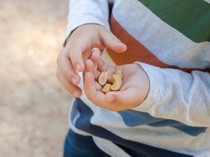 Shutterstock photo / Nut allergy – one of the most common and hardest to outgrow
