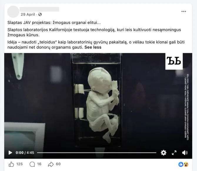 Screenshot from Facebook/Possibility to grow organisms with human organs and tissues in laboratories, but without consciousness, is still theoretical and quite criticized