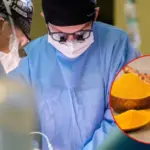 After turmeric consumption – on the operating table: a liver transplant was even needed