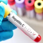 Lithuania's success in the fight against hepatitis C recognized internationally: prestigious award to the professor