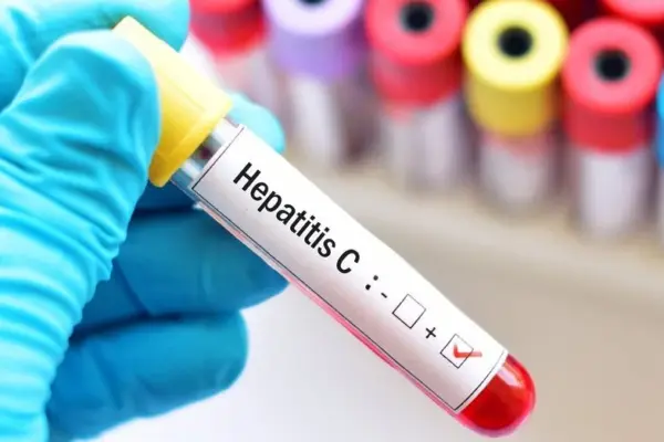 Lithuania's success in the fight against hepatitis C recognized internationally: prestigious award to the professor