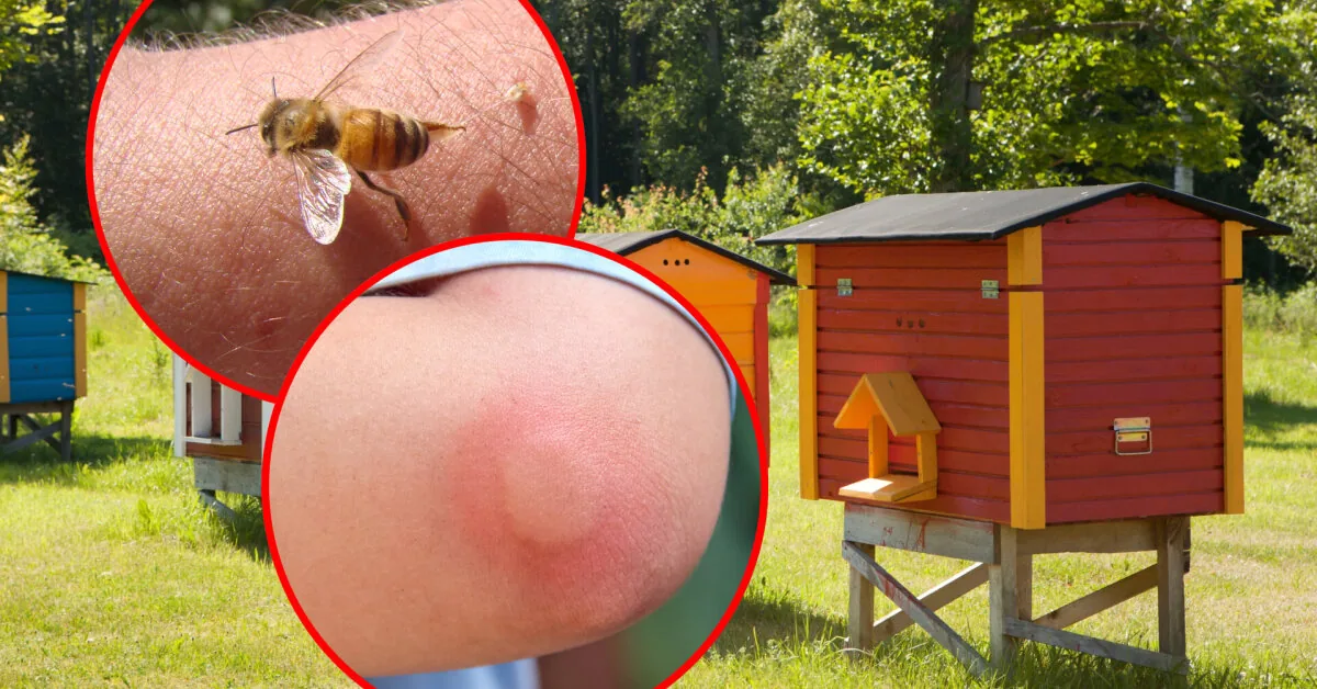 Neighbor bees turned Alma's life into hell: "I have to run away from my own plot"