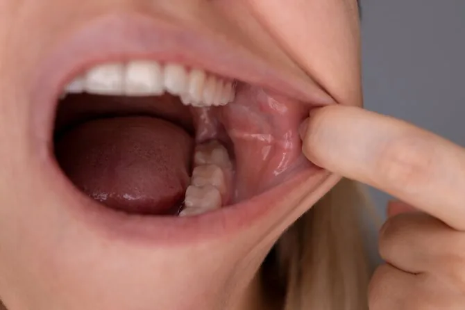 Shutterstock photo/Oral health