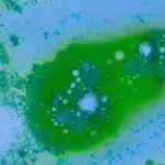 Deadly dangerous bacteria in the Baltic Sea: 2 people have already died in Germany