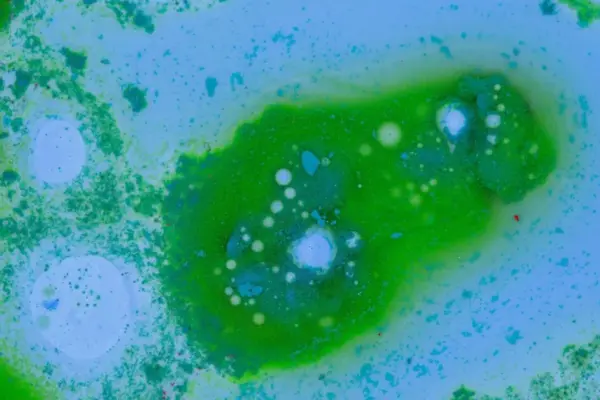 Deadly dangerous bacteria in the Baltic Sea: 2 people have already died in Germany