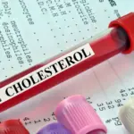These 6 products dangerously increase cholesterol levels: you'd better give them up!