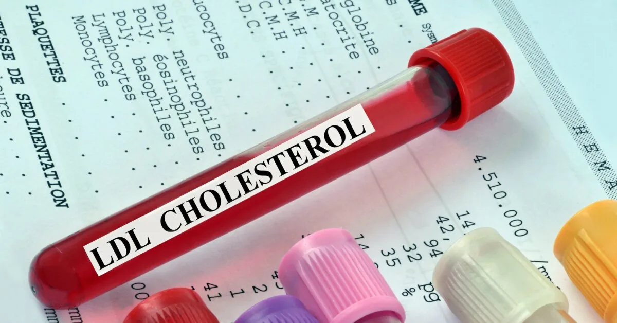 These 6 products dangerously increase cholesterol levels: you'd better give them up!