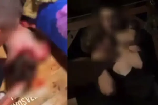 After reports of a possible brutal beating of a young man in Druskininkai, the police launched an investigation
