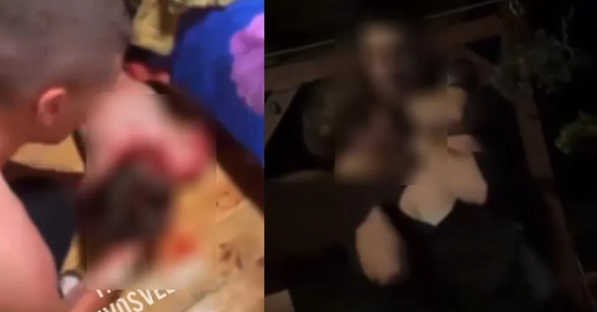 After reports of a possible brutal beating of a young man in Druskininkai, the police launched an investigation