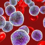 Are you taking iron, but the levels are not improving? A hematologist warns about a frequently ignored cause