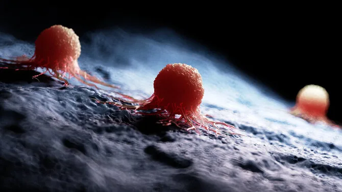 Shutterstock image/Cancer cells
