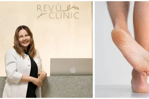 Foot problems can indicate more serious diseases: A new clinical podology center is being established in Lithuania