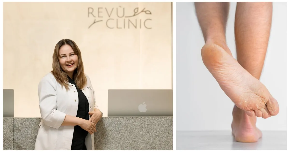 Foot problems can indicate more serious diseases: A new clinical podology center is being established in Lithuania