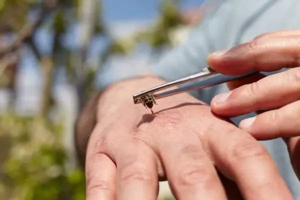 A specialist explained how to safely use bee products and why self-medication can end tragically