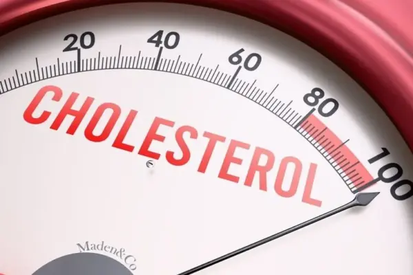 Cardiologists warn everyone: here is how to recognize that your cholesterol is too high