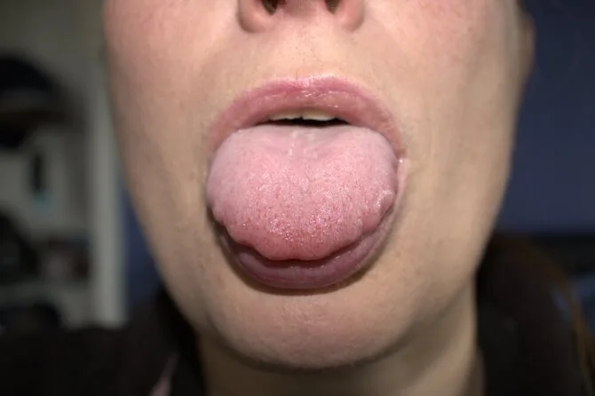 Shutterstock photo/ Tongue