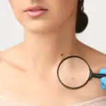 Young woman's life claimed by melanoma: left an important message before death