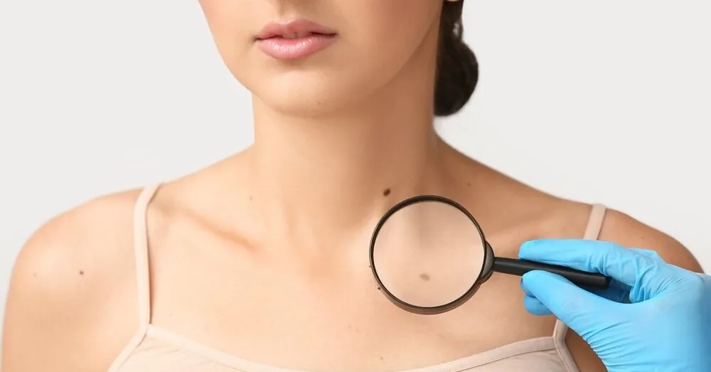 Young woman's life claimed by melanoma: left an important message before death