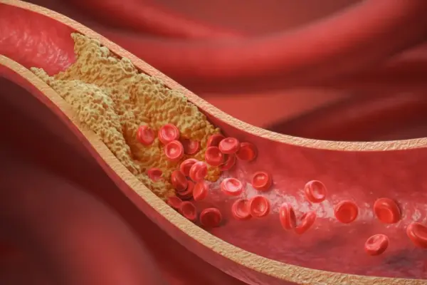 Cardiologist named the No. 1 product for lowering cholesterol: just a handful a day is enough