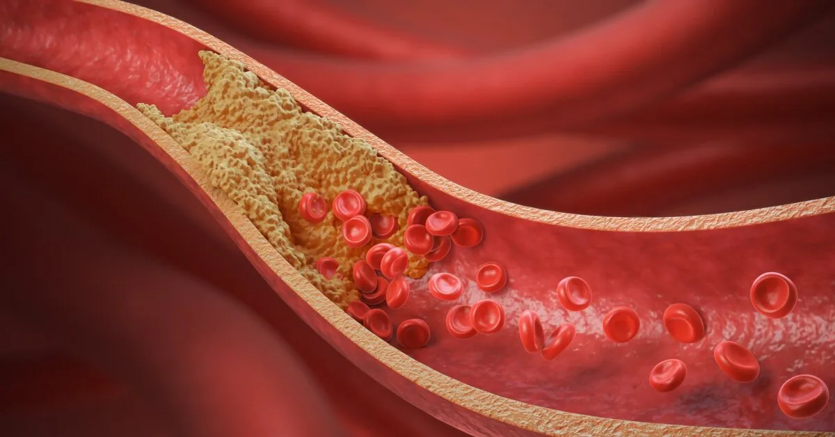 Cardiologist named the No. 1 product for lowering cholesterol: just a handful a day is enough