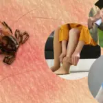 Scientists evaluated tick protection measures: what works best?