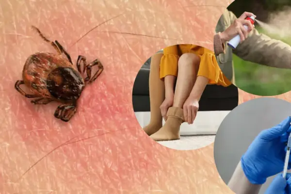 Scientists evaluated tick protection measures: what works best?