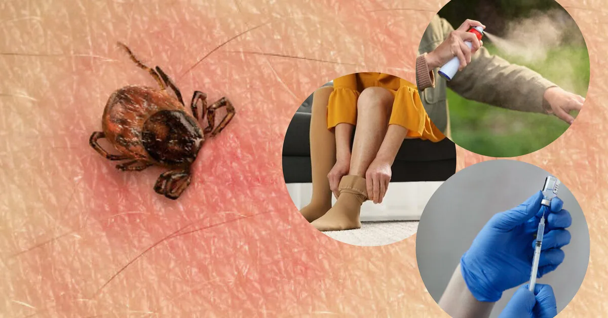 Scientists evaluated tick protection measures: what works best?