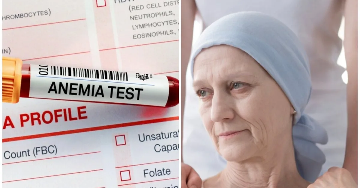 Doctors thought I had an iron deficiency, but a much more severe diagnosis emerged – cancer