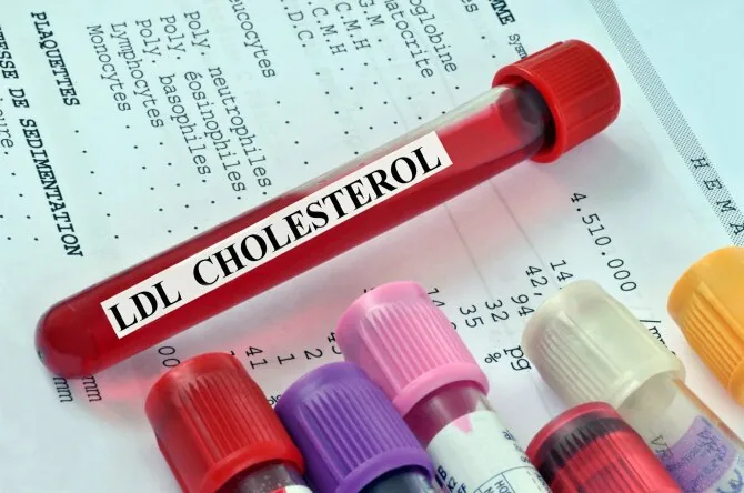 Shutterstock photo/Cholesterol