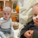 Your 3-month-old Emet diagnosed with leukemia: an invaluable gift to parents on the second birthday