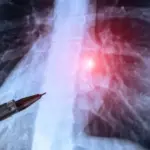 Why does one smoker get cancer, and another does not? Finally, scientists have found the answer