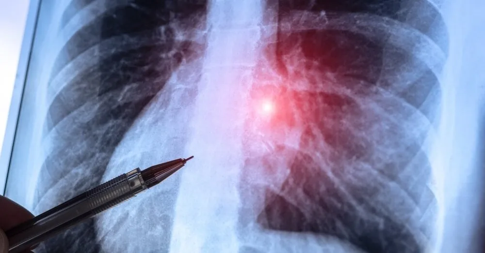 Why does one smoker get cancer, and another does not? Finally, scientists have found the answer