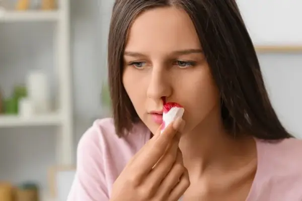 Nosebleed: pharmacist identifies the biggest mistake many make