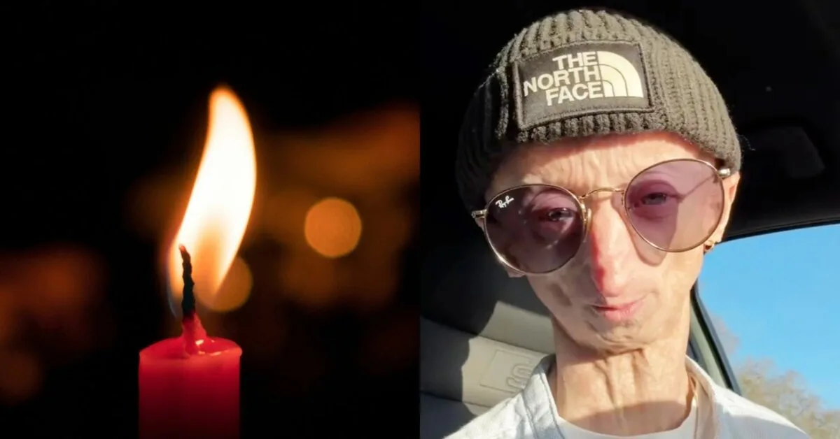 The 28-year-old influencer who defied doctors' predictions has died: his story moved thousands