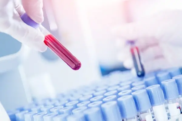 Basophils: what they are, their normal levels in the blood, and what increased or decreased values indicate?