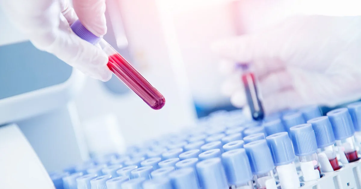 Basophils: what they are, their normal levels in the blood, and what increased or decreased values indicate?