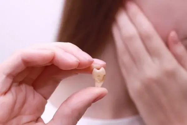 After wisdom tooth extraction, do not make this mistake: it can significantly prolong healing