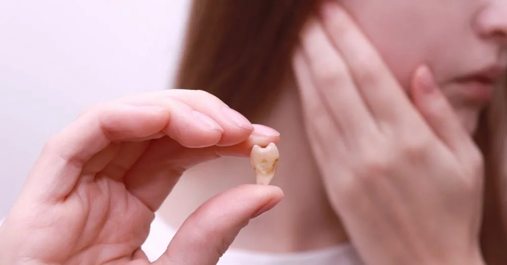 After wisdom tooth extraction, do not make this mistake: it can significantly prolong healing