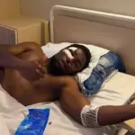 Painful cheekbone injury of "Džiugas" defender: 5 metal plates inserted after surgery
