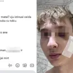 In Klaipėda, a gang of teenagers brutally beat a young man: "The image is cracked, isn't it?"