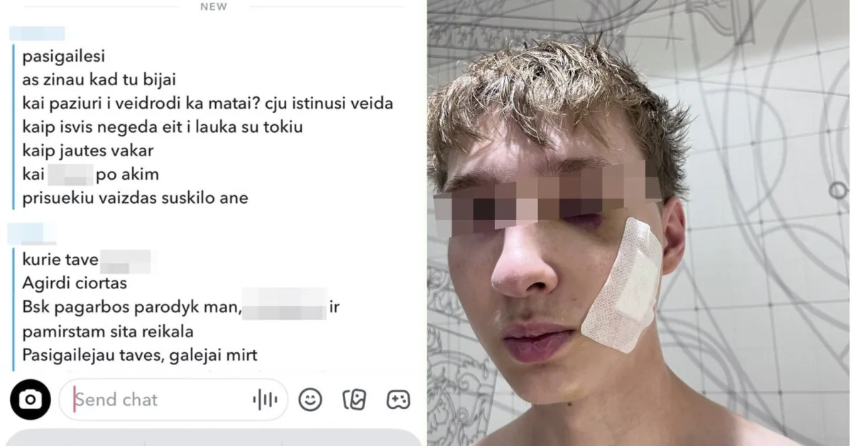 In Klaipėda, a gang of teenagers brutally beat a young man: "The image is cracked, isn't it?"