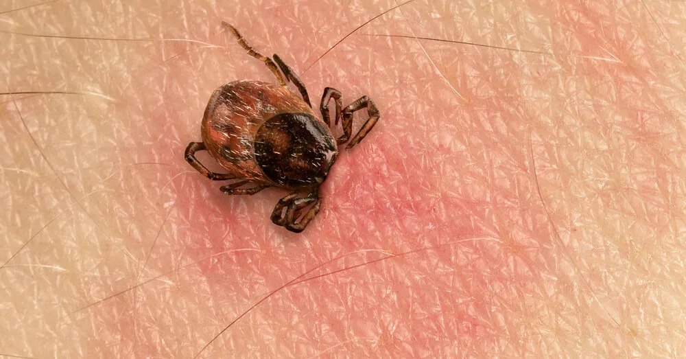 Less common than Lyme disease, but much more dangerous: doctors warn about tularemia