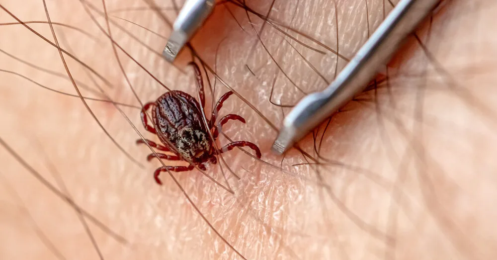 Swede discovered a tick in an incredible place: even experienced doctors were puzzled about how to remove it